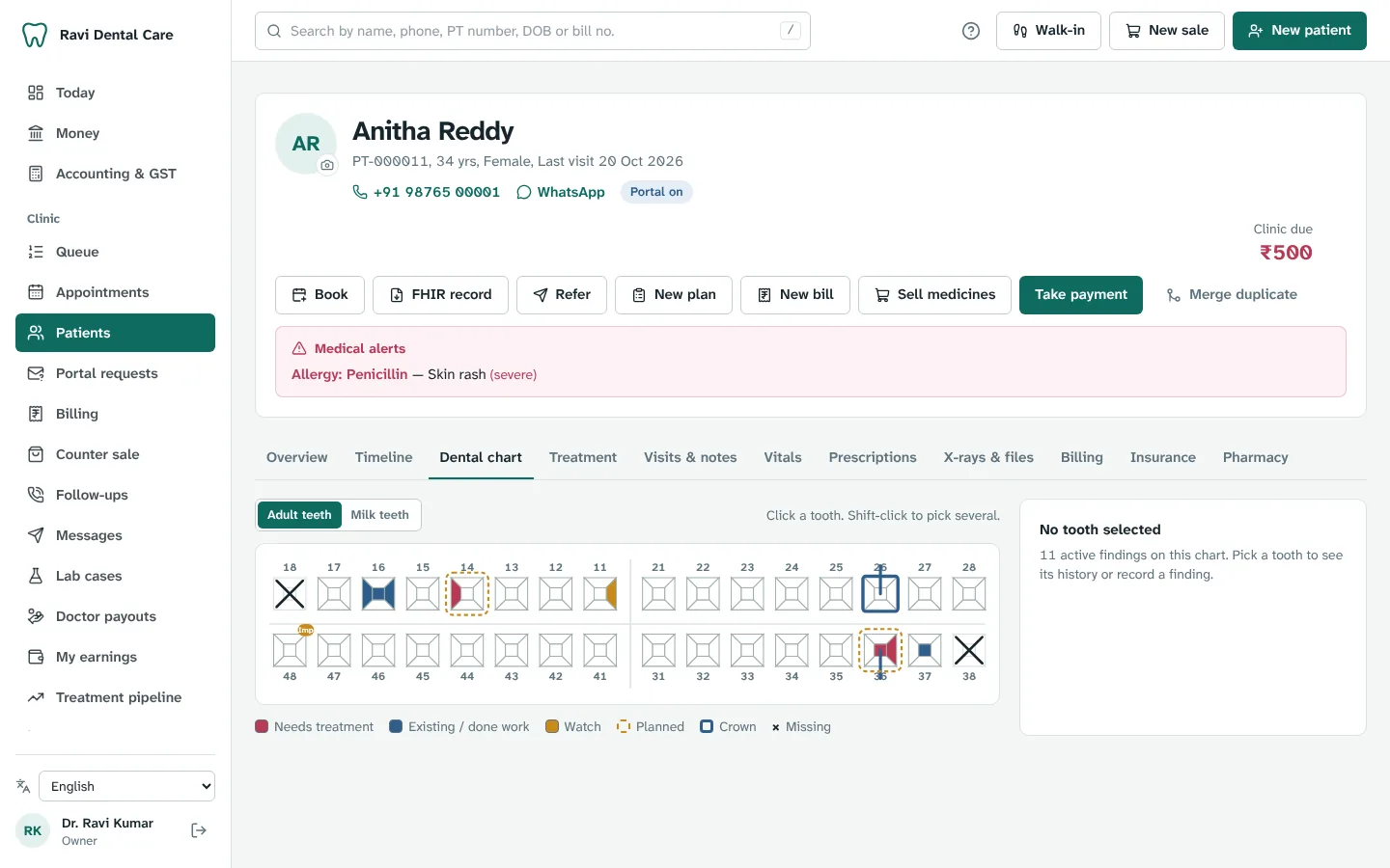 A patient's dental chart, with medical alerts at the top